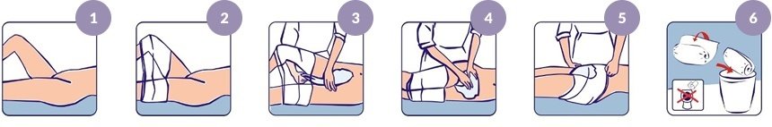 Technique de pose du iD Expert Form en position couché
